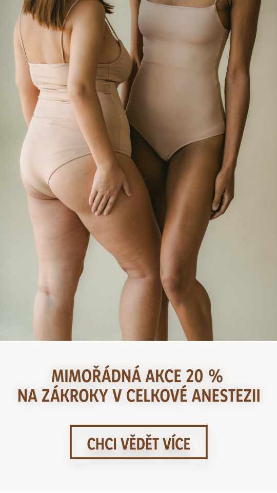 Banner: Mimořádná akce 20 % na zákroky v celkové anestezii!